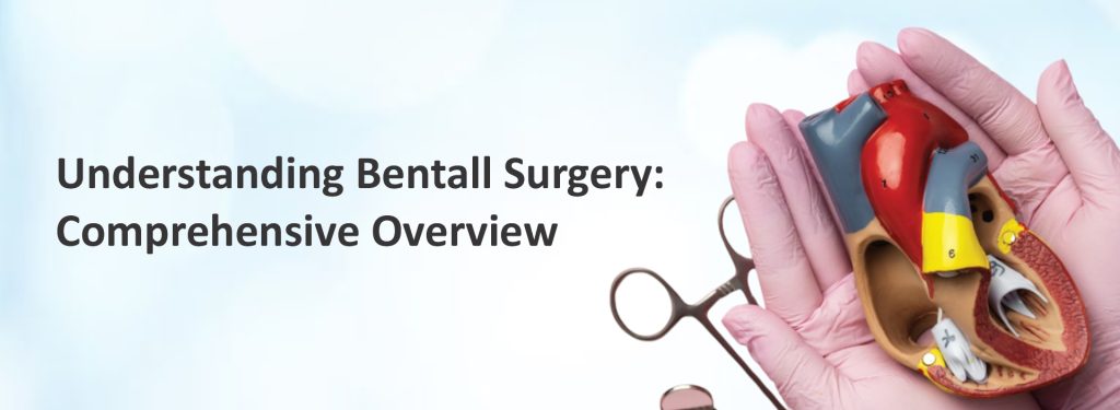 Understanding Bentall Surgery: Comprehensive Overview