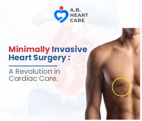 Minimally Invasive Cardiac Surgery in Chandigarh