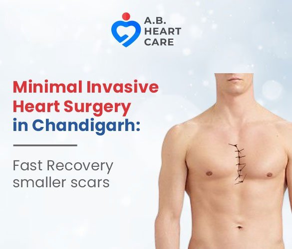 Minimally Invasive Heart Surgery: Faster Recovery, Smaller Scars